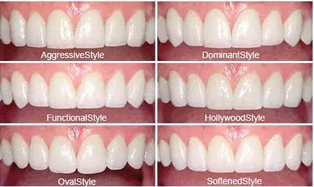 carillas, carillas, más barato, miami, kendall, centro de la ciudad, playa sur, fiu, más cercano a mí, dentista cerca de mí, dentista cerca de mi, mejor dentista miami, mejor dentista miami, pizza cerca de mí, chino cerca de mí, comida cerca de mí, corona dentista miami, dentista más barato miami, dentista de conducto radicular miami, conducto radicular más barato de miami
