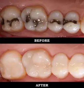 Dentista cerca de mí, dentista cerca de mí, mejor dentista de miami, mejor dentista de miami, pizza cerca de mí, chino cerca de mí, comida cerca de mí, dentista de corona en miami, dentista más barato en miami, dentista de tratamiento de conductos en miami, dentista de tratamiento de conductos en miami más barato
